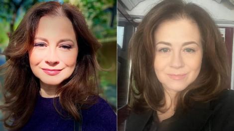 Corina Dănilă a apelat la ajutorul medicului estetician. Ce schimbare și-a făcut vedeta