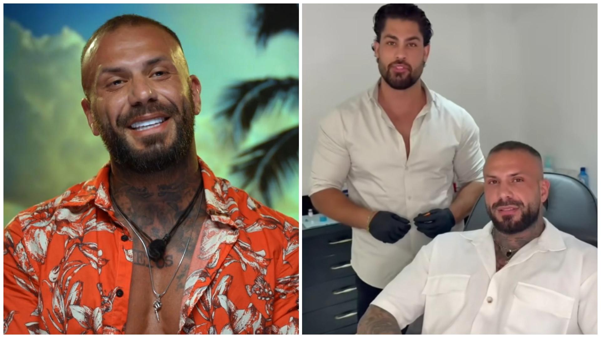 Colaj Narcis Bujor la testimonial și în cabinetul medicului estetician, Auday Al-Ahmad