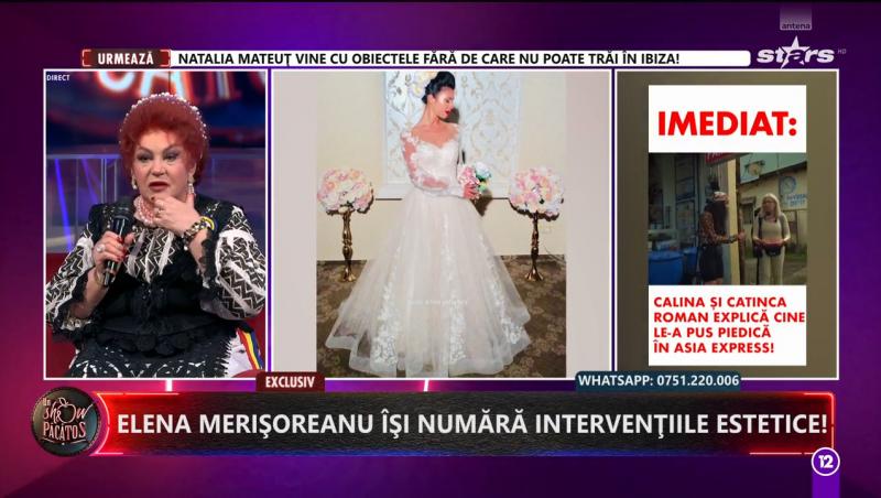 Câte intervenții estetice are Elena Merișoreanu. Artista nu a ezitat să recunoască faptul că apelează la ajutorul esteticienilor