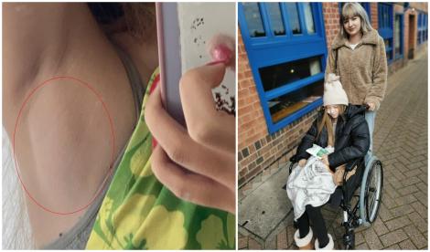 O fată tușea și a crezut că e doar o simplă răceală. Când a ajuns la spital medicul i-au pus un diagnostic dificil. Ce avea