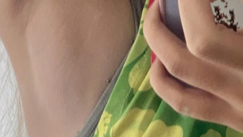 O fată tușea și a crezut că e doar o simplă răceală. Când a ajuns la spital medicul i-au pus un diagnostic dificil. Ce avea