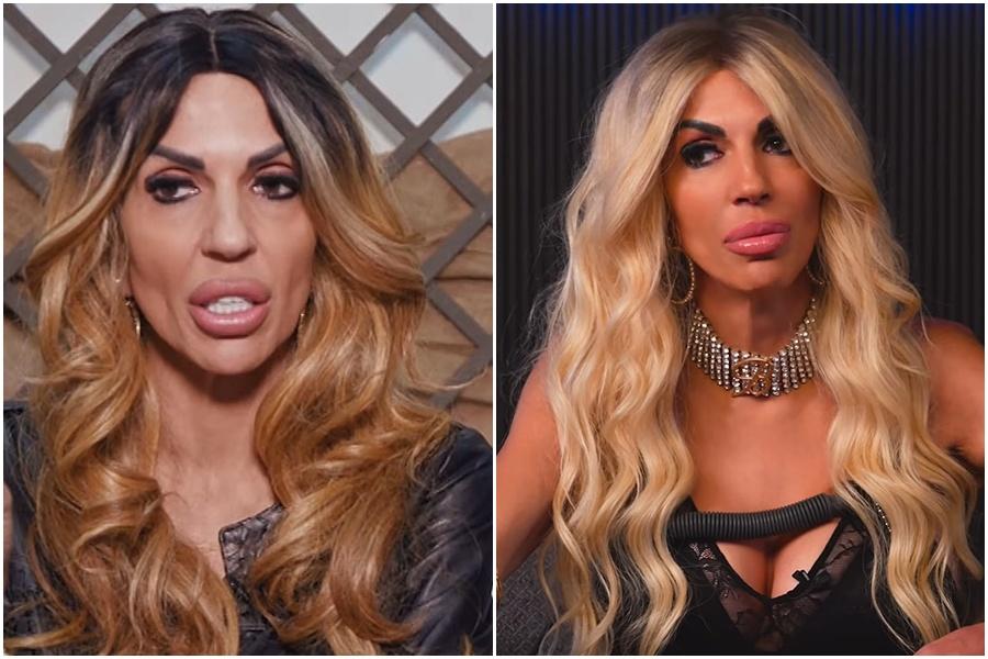 Cu ce probleme de sănătate se confruntă Raluca Bădulescu. Diagnosticul pus de medici