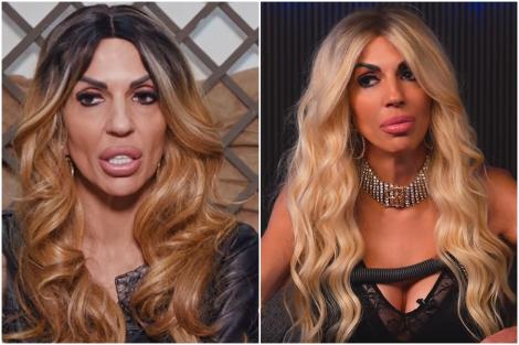 Cu ce probleme de sănătate se confruntă Raluca Bădulescu. Diagnosticul pus de medici