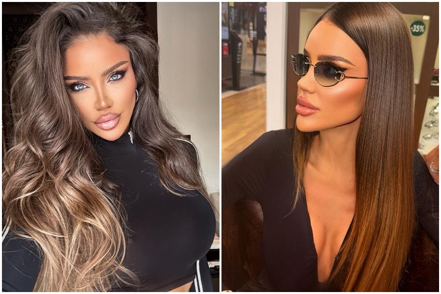 Cum arată Bianca Drăgușanu după o nouă operație la nivelul buzelor. Ce și-a făcut: „Recuperarea a fost ușoară”