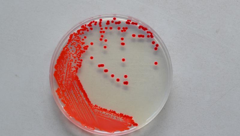 Ce este bacteria Serratia Marcescens, responsabilă de tragediile de la Spitalul de Copii „Sfânta Maria” din Iași