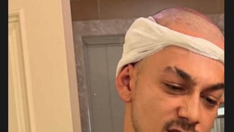 Juno, anunț surprinzător în mediul online. Artistul s-a lăsat pe mâna medicilor. Ce schimbare a făcut