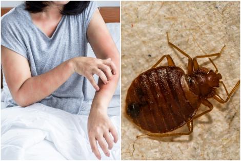 Semnele care &icirc;ți arată că ai ploșnițe de pat &icirc;n casă. Unde se ascund și cum poți scăpa de ele