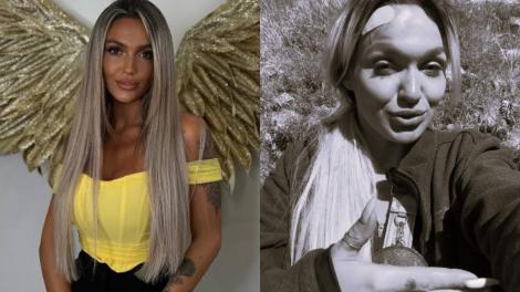 Ella Vișan de la Insula Iubirii a căzut aproximativ 100 de metri pe munte. Cum arată după accident: &bdquo;A fost groaznic&rdquo;