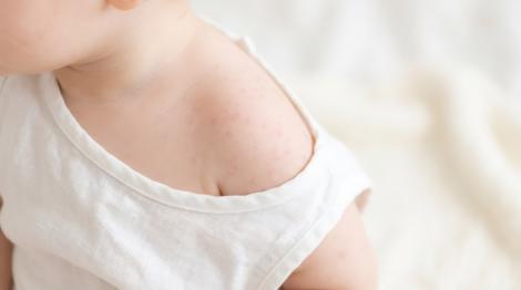 (P) Lista pentru părinți cu semnele de alarmă care transformă o simplă iritație &icirc;ntr-o urgență medicală pediatrică