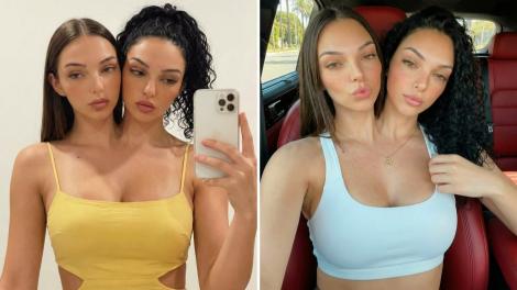 Cine sunt, de fapt, Valeria și Camila, gemenele siameze care au pus pe jar internetul! Toți răm&acirc;n uimiți c&acirc;nd le văd