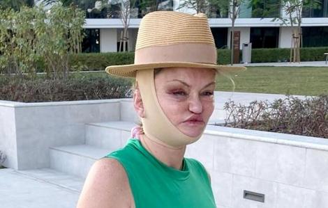 Vedeta care a fost forțată să apeleze la intervenții chirurgicale, dar trebuie să apară așa &icirc;n public. Cum arăta &icirc;nainte