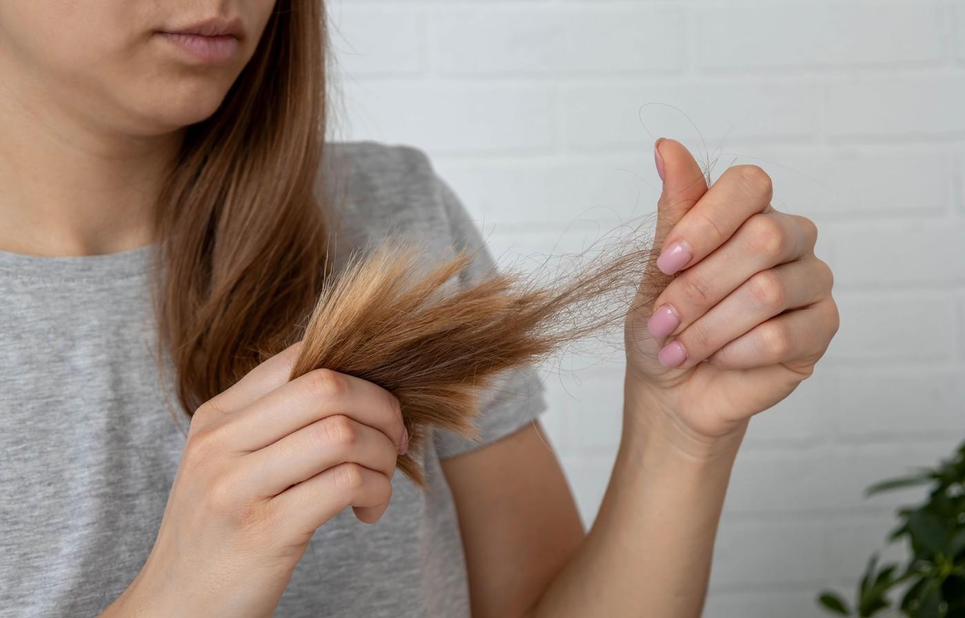 O t&acirc;nără a văzut că &icirc;i cade părul mult, dar a zis că e de la stres. C&acirc;nd și c&acirc;inele a pățit la fel i s-a părut bizar. Ce a găsit