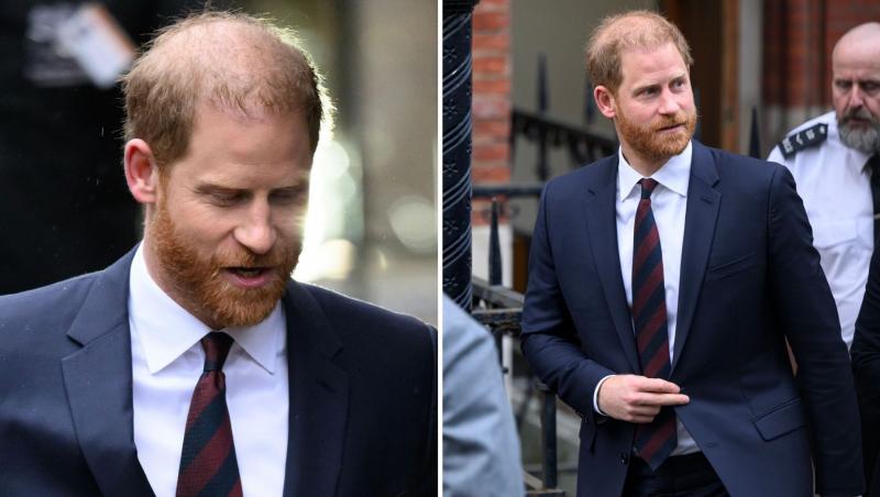 Prințul Harry, tot mai amenințat de chelie. Aparițiile recente trezesc îngrijorare
