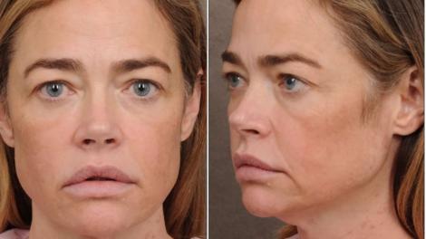 A avut curajul să se pozeze &icirc;nainte și după liftingul facial: transformarea uneia dintre cele mai frumoase actrițe de la Hollywood