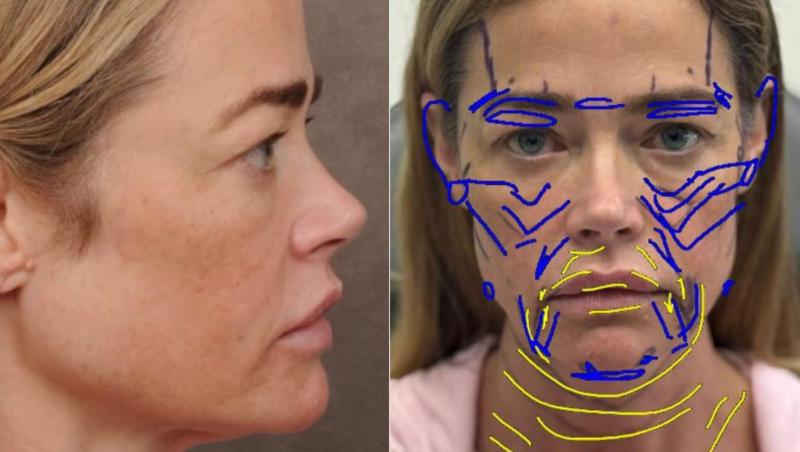 A avut curajul să se pozeze înainte și după liftingul facial: transformarea uneia dintre cele mai frumoase actrițe de la Hollywood