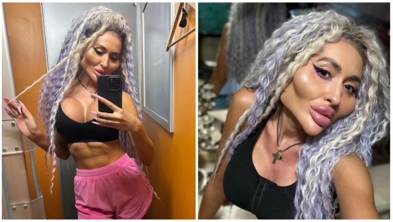 Cum arăta femeia cu „cei mai mari pomeți din lume” înainte de intervențiile estetice. Era o persoană diferită în urmă cu 9 ani