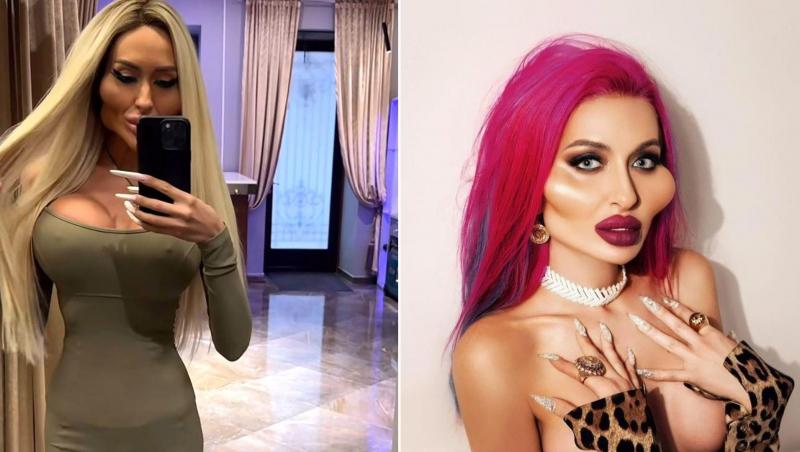 Cum arăta femeia cu „cei mai mari pomeți din lume” înainte de intervențiile estetice. Era o persoană diferită în urmă cu 9 ani