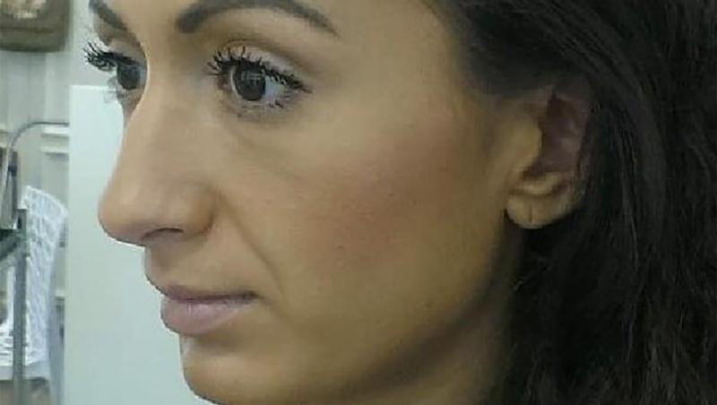 Cum arăta femeia cu „cei mai mari pomeți din lume” înainte de intervențiile estetice. Era o persoană diferită în urmă cu 9 ani