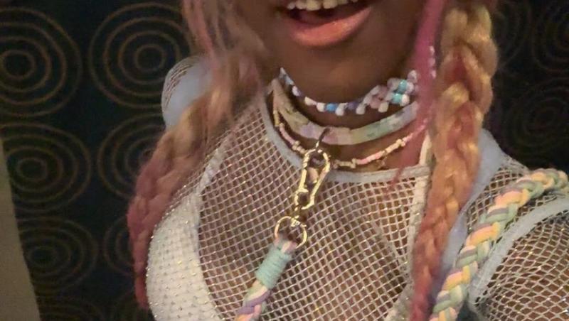 O tânără de 20 de ani se crede câine și va fi supusă unei operații de 640 de dolari pentru a-și pune colți. Cum arată