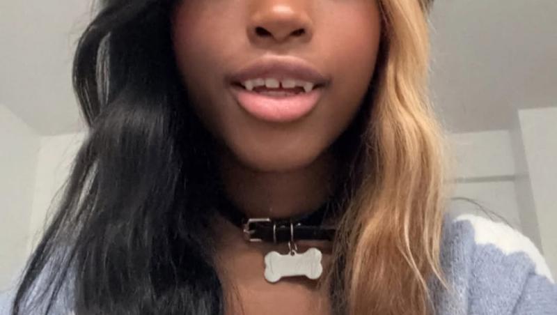 O tânără de 20 de ani se crede câine și va fi supusă unei operații de 640 de dolari pentru a-și pune colți. Cum arată