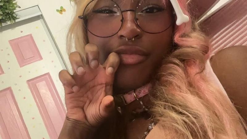 O tânără de 20 de ani se crede câine și va fi supusă unei operații de 640 de dolari pentru a-și pune colți. Cum arată