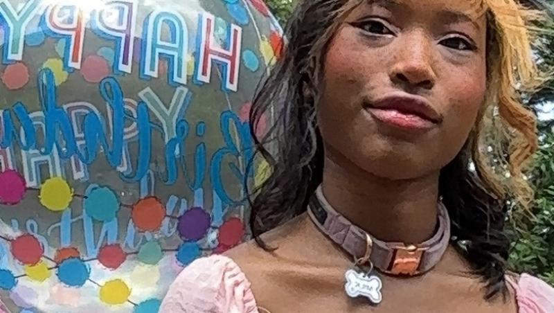 O tânără de 20 de ani se crede câine și va fi supusă unei operații de 640 de dolari pentru a-și pune colți. Cum arată