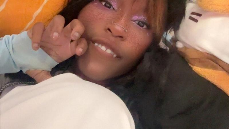 O tânără de 20 de ani se crede câine și va fi supusă unei operații de 640 de dolari pentru a-și pune colți. Cum arată