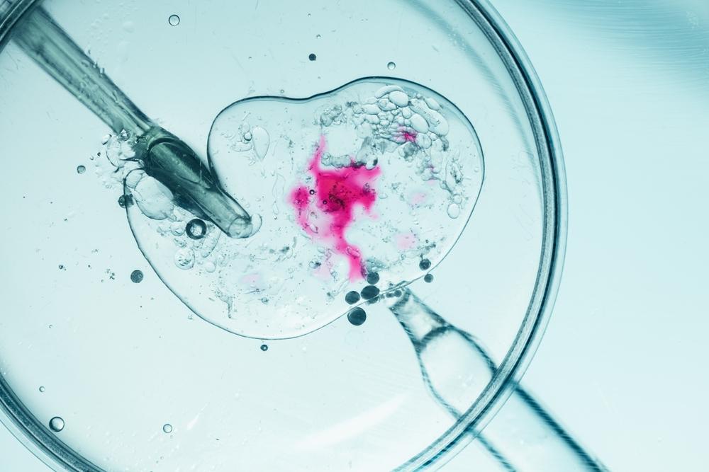 &Icirc;n ce constă procedura de fertilizare in vitro. Etapele FIV, explicate de medicul specialist &icirc;n infertilitate