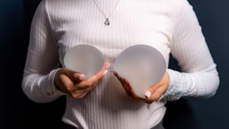 I-a plătit implanturile mamare soției, iar la divorț a vrut banii &icirc;napoi! Cererea care i-a lăsat pe mulți fără cuvinte. Ce a urmat