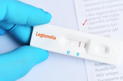 Ce este Legionella, bacteria contractată de angajata Metrorex după inundațiile din data de 1 iulie 2026