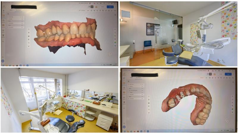 colaj foto cu imagini dintr-un cabinet stomatologic si imagini cu mulaje dentare
