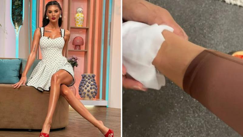 Ramona Olaru și-a speriat fanii după ce s-a afișat cu piciorul plin de s&acirc;nge. Ce a pățit vedeta de la Neatza