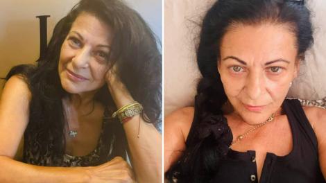 Ce decizie e nevoită să ia Elena C&acirc;rstea din cauza problemelor de sănătate. Ce apel a făcut artista &icirc;n mediul online