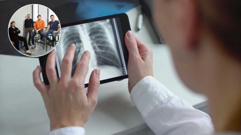 Tehnologia rom&acirc;nească ce ar putea ajuta medicii &icirc;n lupta cu o boală grea. Inteligența artificială va analiza investigațiile CT