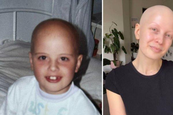 Avea șase ani, iar mama ei i-a spus să &icirc;și radă tot părul din cap. 30 de ani mai t&acirc;rziu, nu i-a mai crescut deloc. Care e motivul