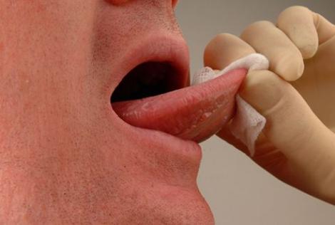 VIDEO! Ce stii despre "taiatul sub limba"?