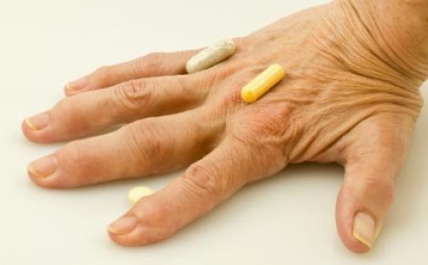7 mituri neadevarate despre artrita