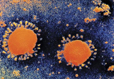 A fost descoperit un virus asemanator cu SARS, care in 2002 a provocat moartea a 800 de persoane