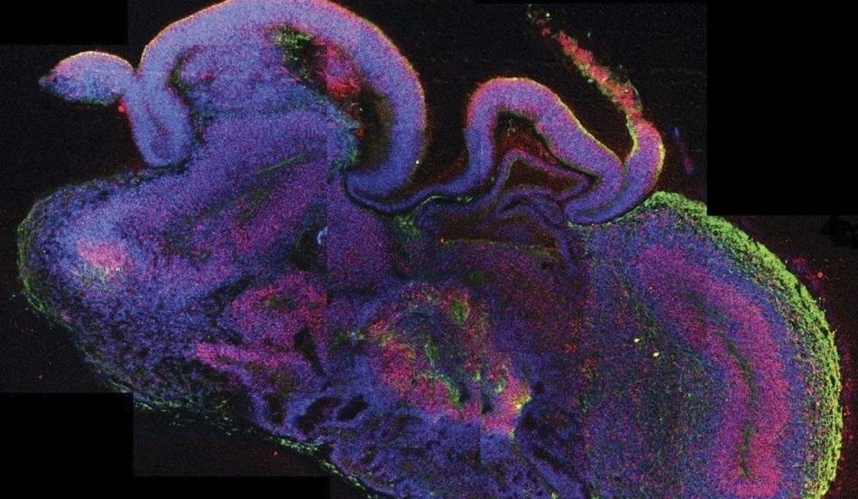 A fost creat un prototip al creierului uman din celule stem!