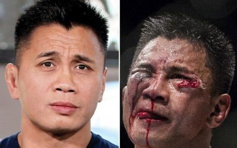 Galerie FOTO: Cum arată luptătorii din UFC după o luptă! ATENȚIE, IMAGINI DURE!!!