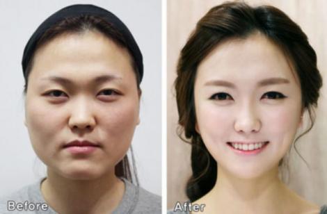 Chirurgia estetică din Coreea de Sud te schimbă RADICAL! Ai nevoie de certificat pentru a fi recunoscut!