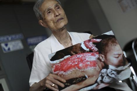 Avea doar 16 ani când a explodat bomba nucleară la Nagasaki! După 70 de ani, corpul lui este o hartă a tragediei!