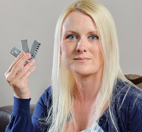 După cinci ani în care a mestecat gumă câte șapte ore pe zi, această femeie a pățit ceva șocant!