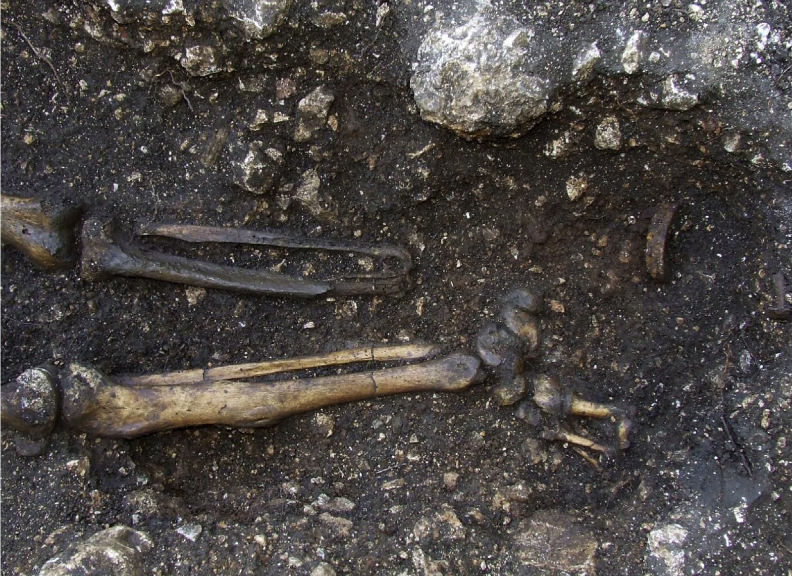 Descoperire uluitoare! A fost găsită cea mai veche proteză din lume, ce a aparținut unui bărbat căruia i-a fost amputat piciorul