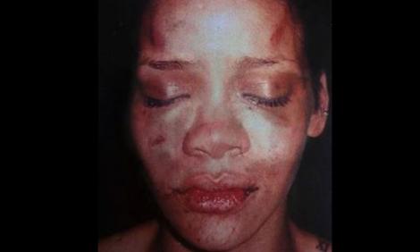 Declarații șocante! Chris Brown a povestit cum a ajuns s-o desfigureze pe Rihanna: ”M-a apucat de testicule! Aveam pumnul strâns şi am lovit-o. I-am spart buza!”