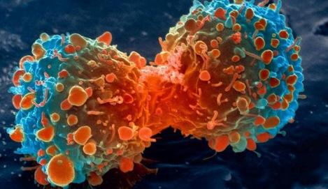 S-a descoperit leacul pentru CANCER! Doi cercetători au primit PREMIUL NOBEL pentru descoperirea unei TERAPII anti-cancer