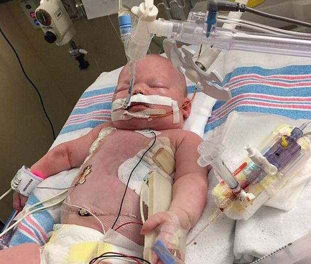 Fetița le-a murit la 8 zile de la naștere, după ce ,,VIRUSUL SĂRUTULUI‘’ i-a mâncat plămânii și creierul. Părinții devastați le scriu pe Facebook un mesaj șocant tututror părinților