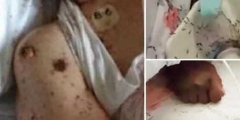 O femeie în stare gravă, găsită acoperită de furnici, în spital! Autoritățile au demarat o anchetă