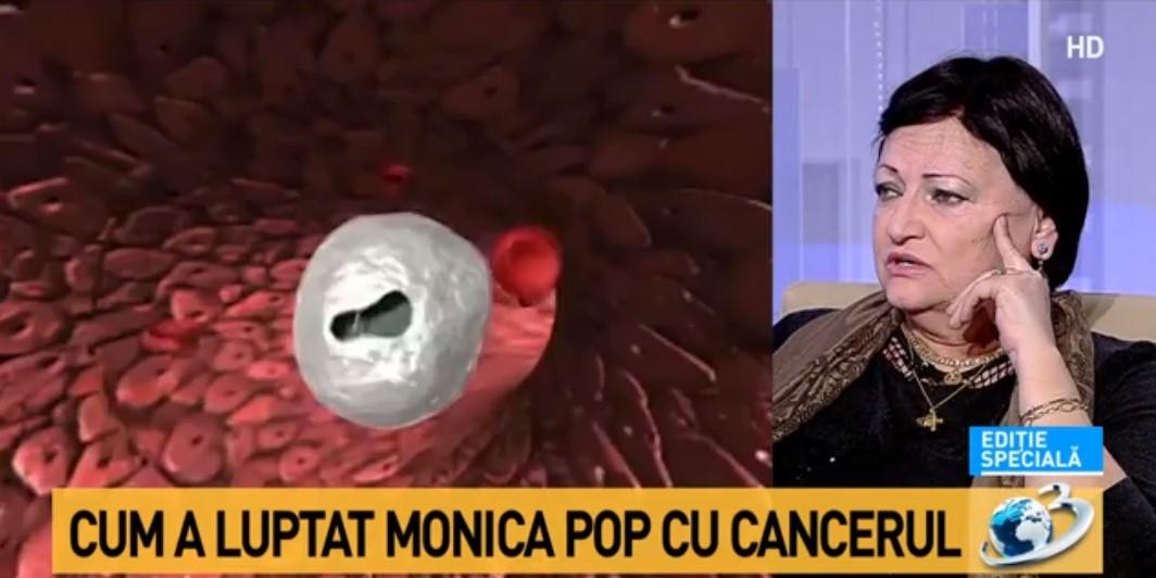 Monica Pop a vorbit despre momentul în care a aflat că avea cancer: „Trebuie să fim atenți la ORICE lucru neobișnuit la corpul nostru”
