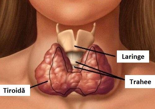Dietele pentru slabit la pacientii cu afectiuni tiroidiene